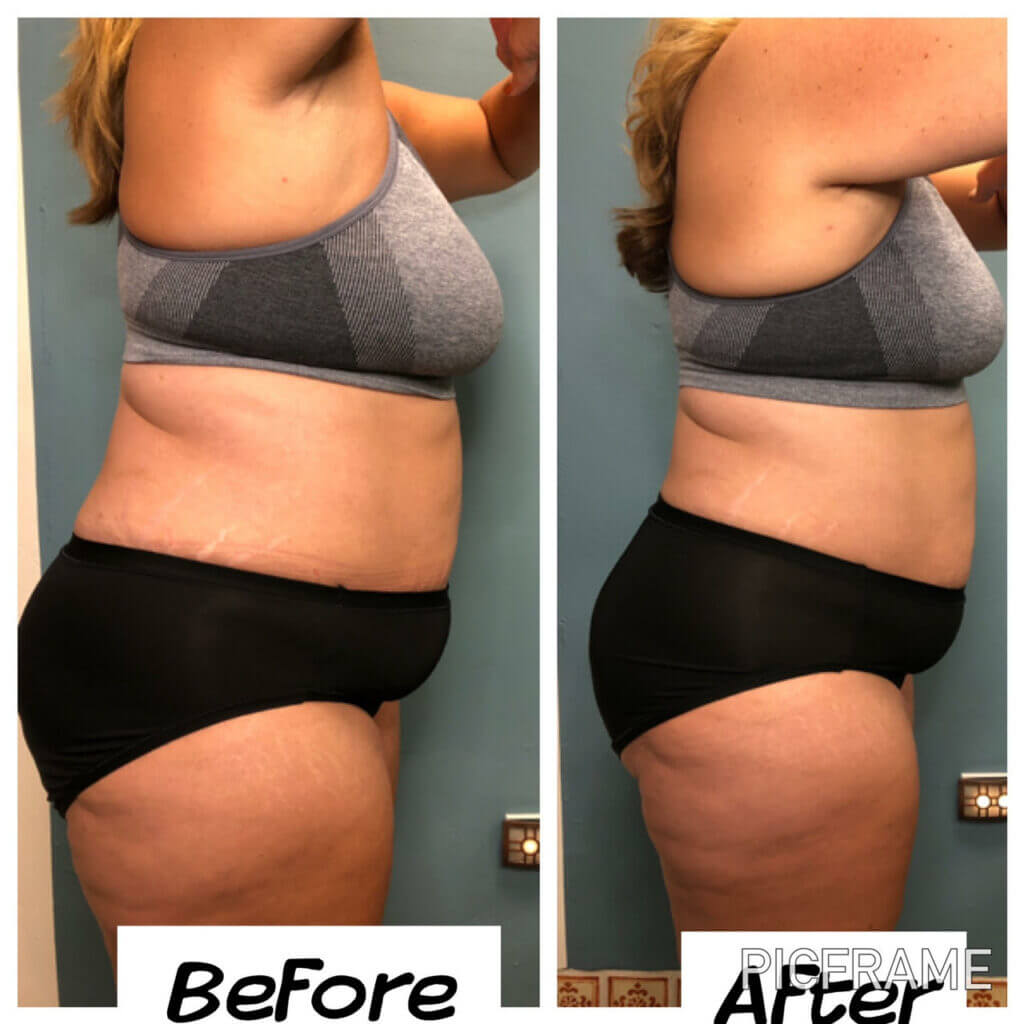 Before And Afters Community Chiropractic Center